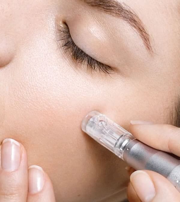 Centro Medicina Estética Salud -Sant Feliu de Guíxols - Inicio - Tratamientos - Microneedling Centro Medicina Estética Salud -Sant Feliu de Guíxols - Inicio - Tratamientos - Microneedling